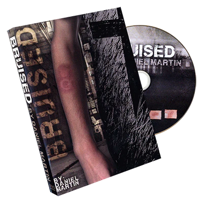 Bruised by Daniel Martin - Trick